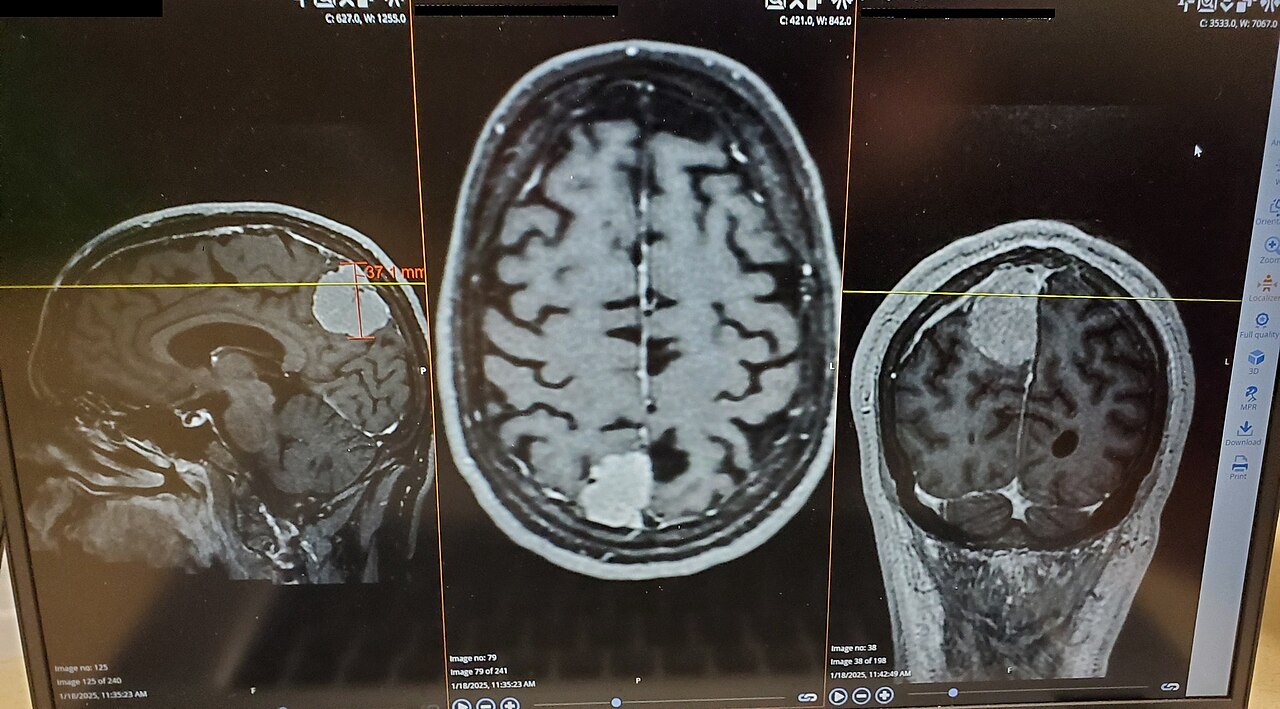 Memory and Neuro Health